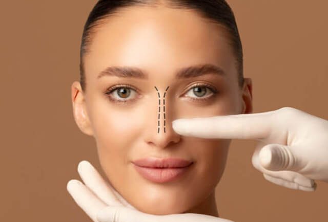 What Rhinoplasty can and cant do - IAAPS