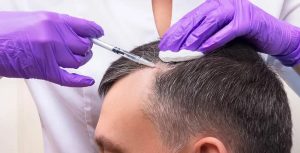 The Hidden Risks and Real Safeguards of Hair Transplantation