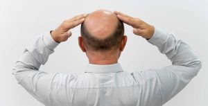 What Can Go Wrong in a Hair Transplant