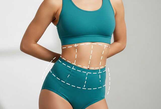 Lipo-Sculpting in Modern Aesthetic Surgery - IAAPS